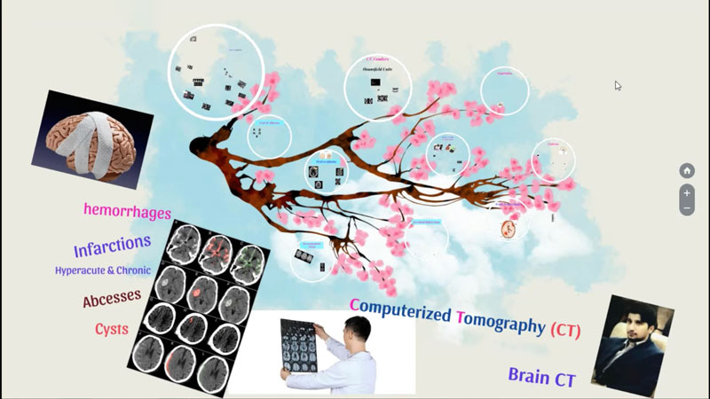 فیلم آموزش بررسی آناتومیک و تفسیر مقدماتی سی تی اسکن مغز Brain CT Scan